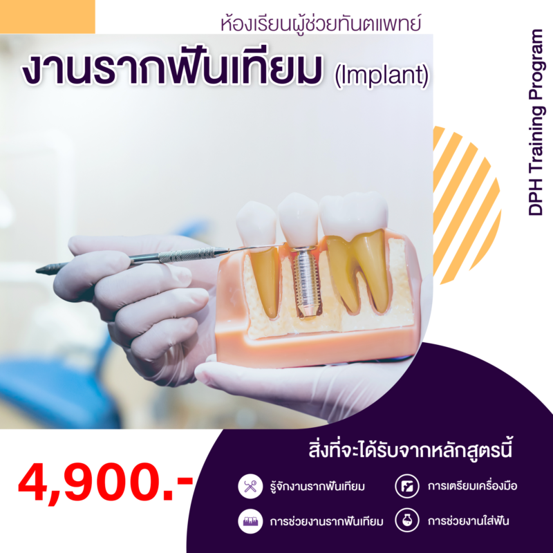 ห้องเรียนผู้ช่วยทันตแพทย์ งานรากฟันเทียม (Implant)